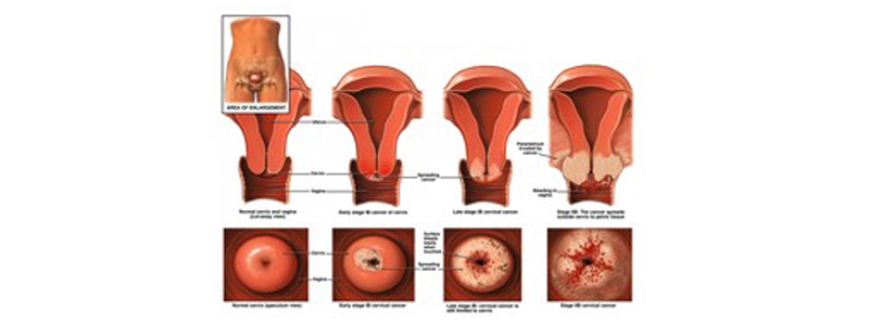 Acheter du clomid en ligne