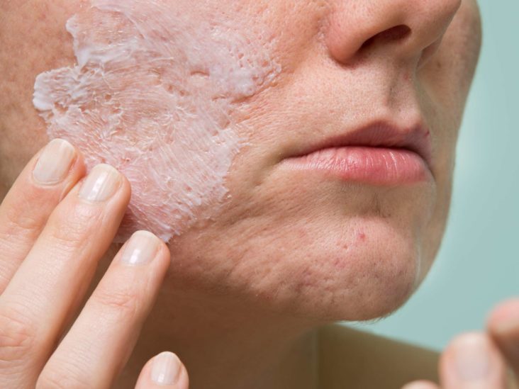 Pilule de roaccutane