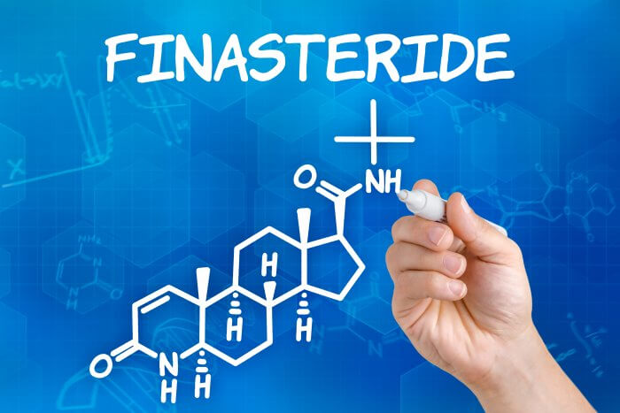 finasteride bon marché