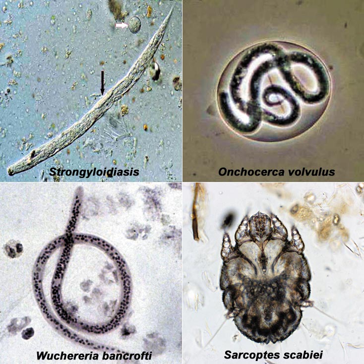 Stromectol 3 mg sans ordonnance