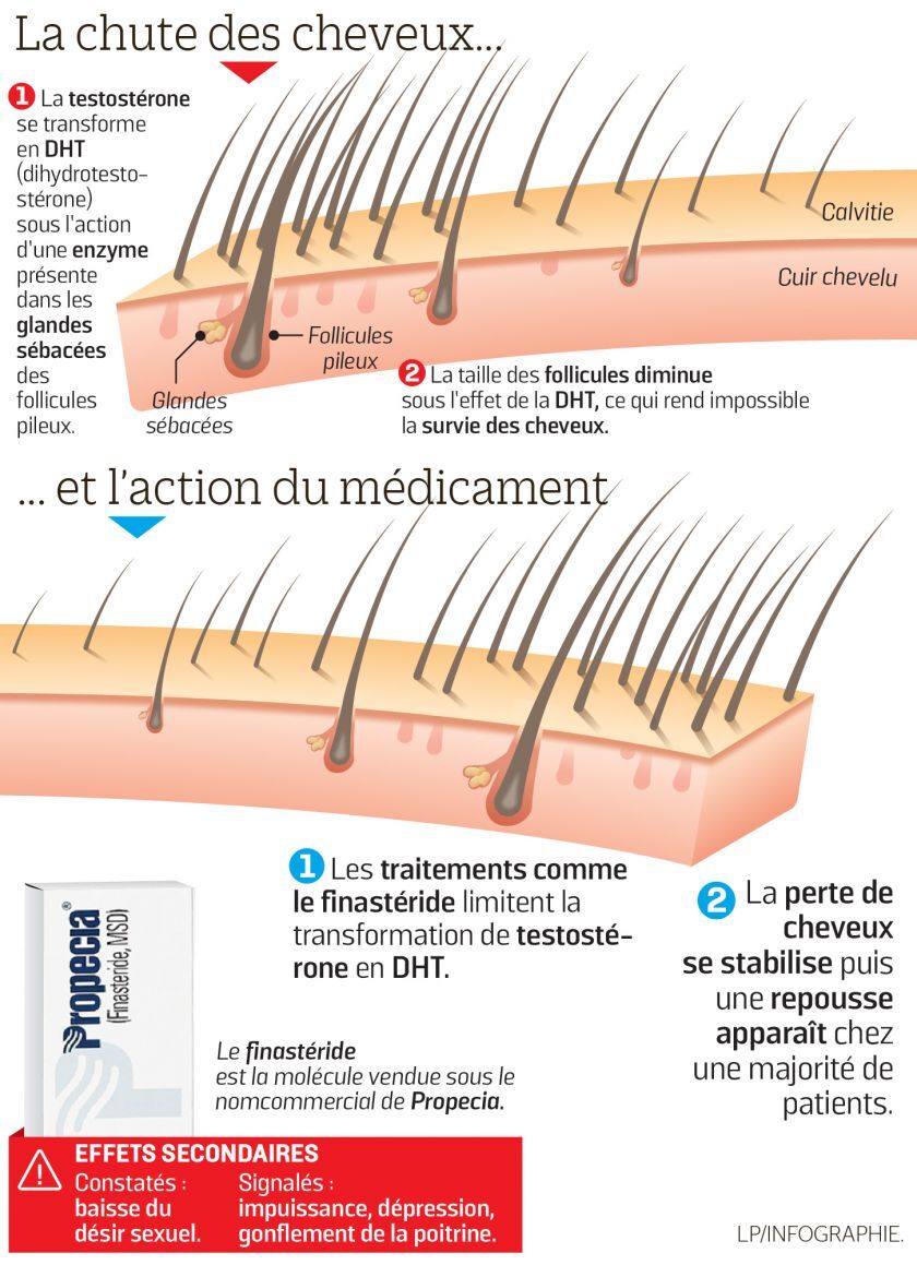 Propecia En France