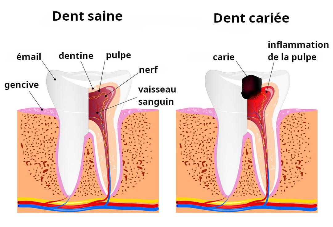 Amoxicilline dent sans ordonnance