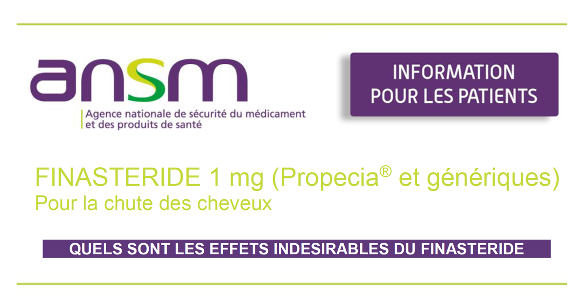 Finasteride Online France