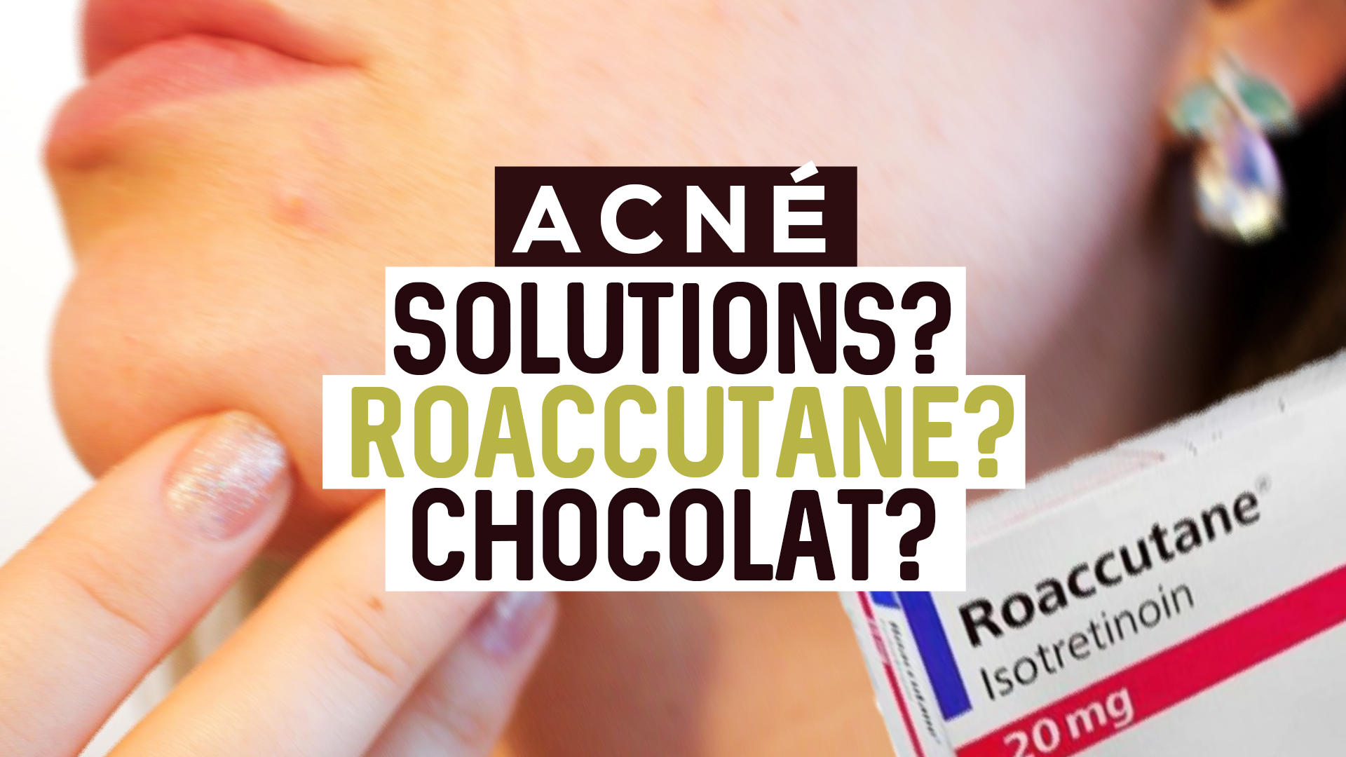 Roaccutane 20mg