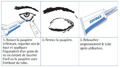 Zovirax ophtalmique sans ordonnance