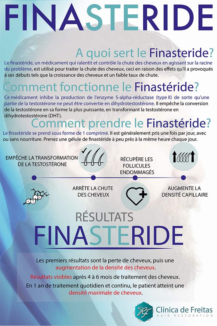 Coût du finastéride