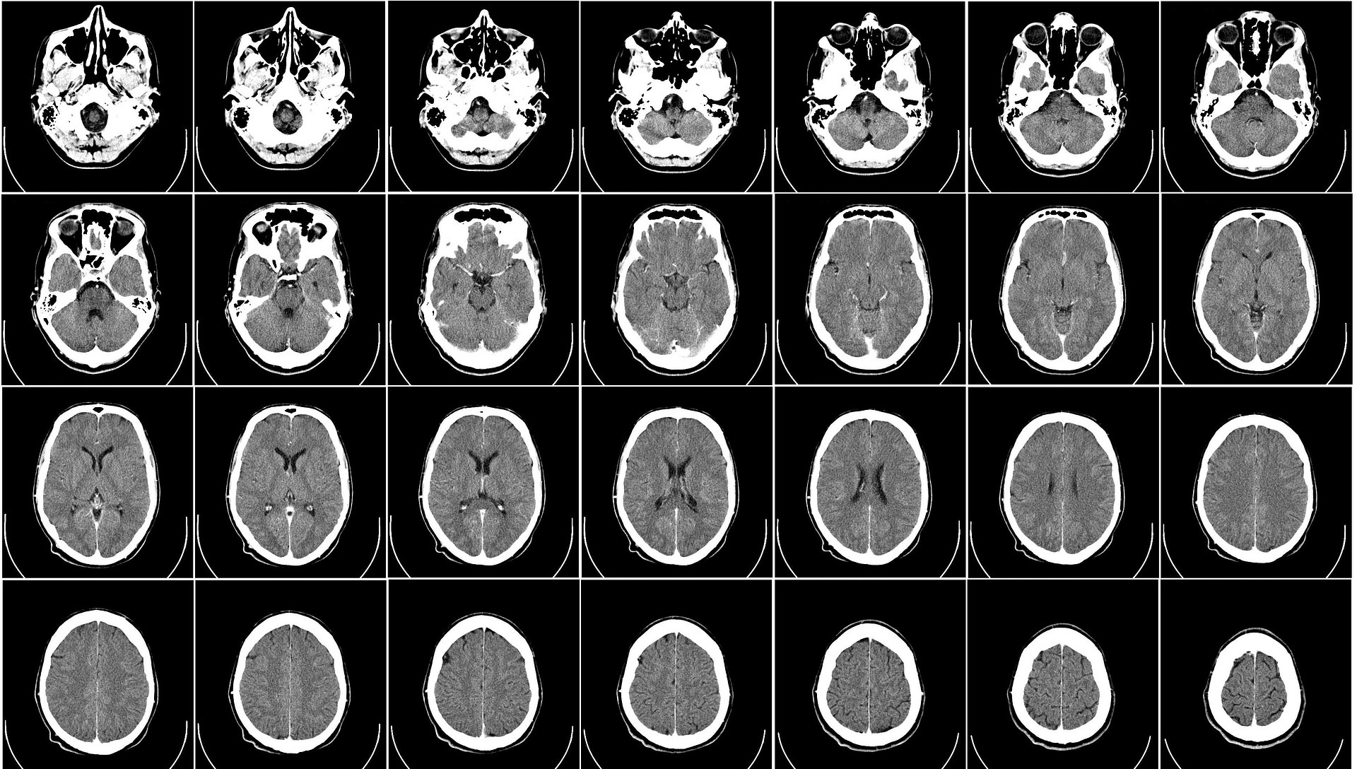 Acheter rivotril gouttes sans ordonnance