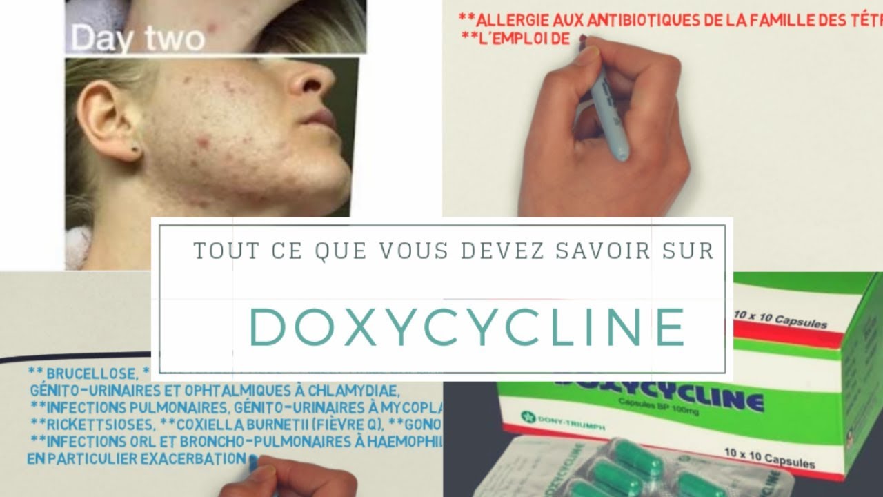 doxycycline 100mg prix