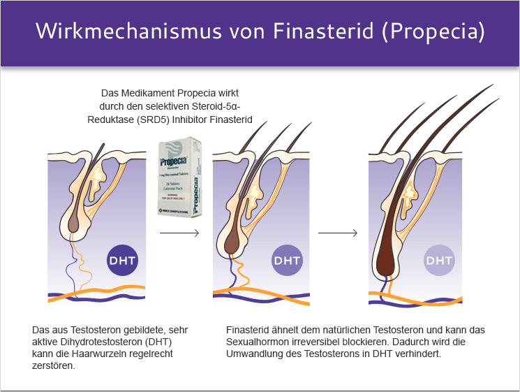 Finasteride 1 mg compra online