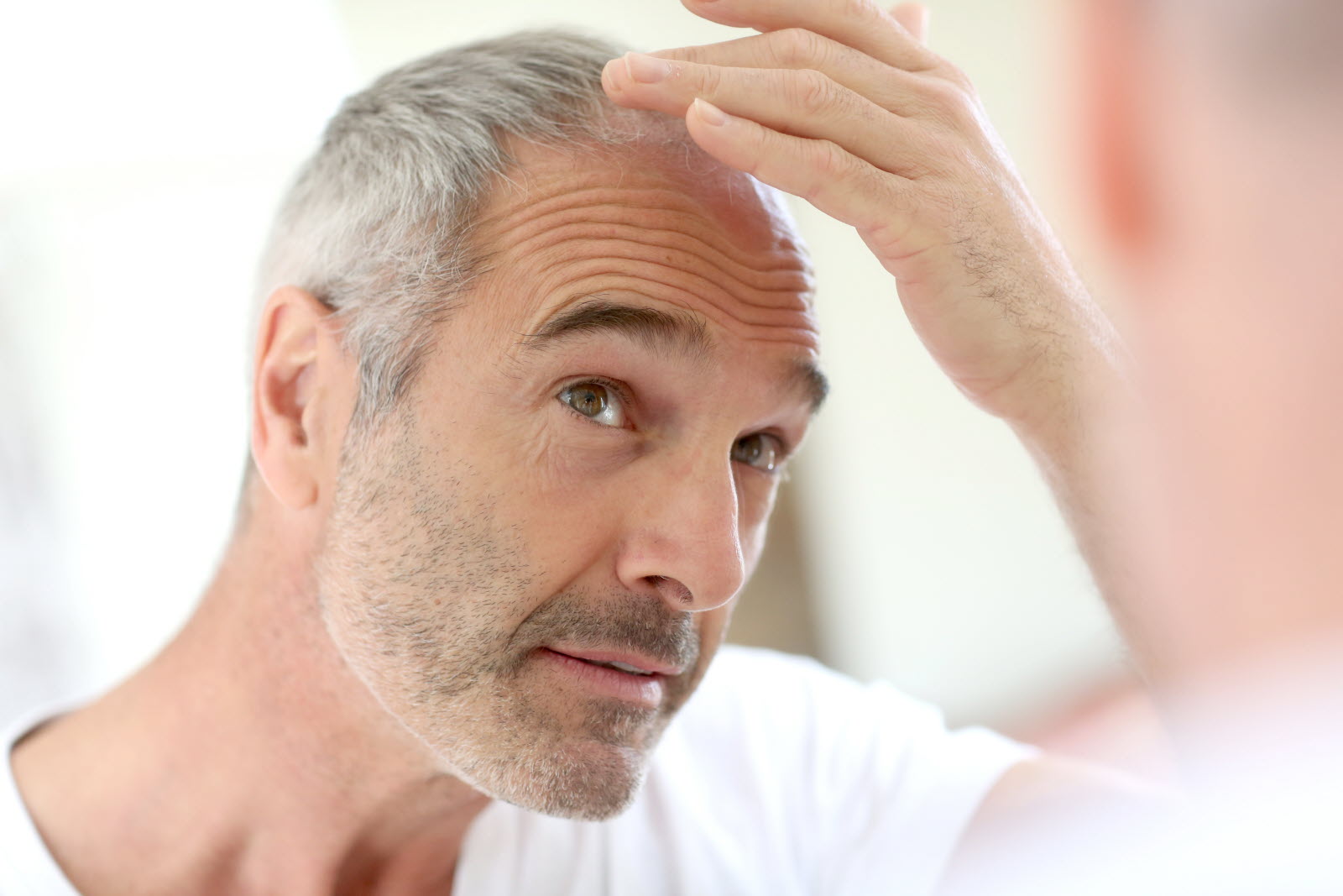 Finasteride In France