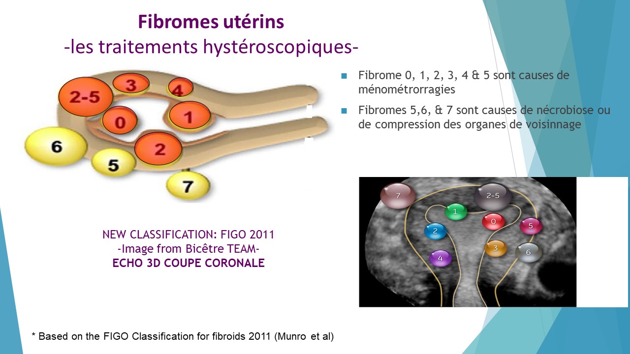 Prix clomiphene