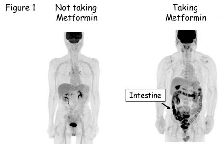 Prix du metformin