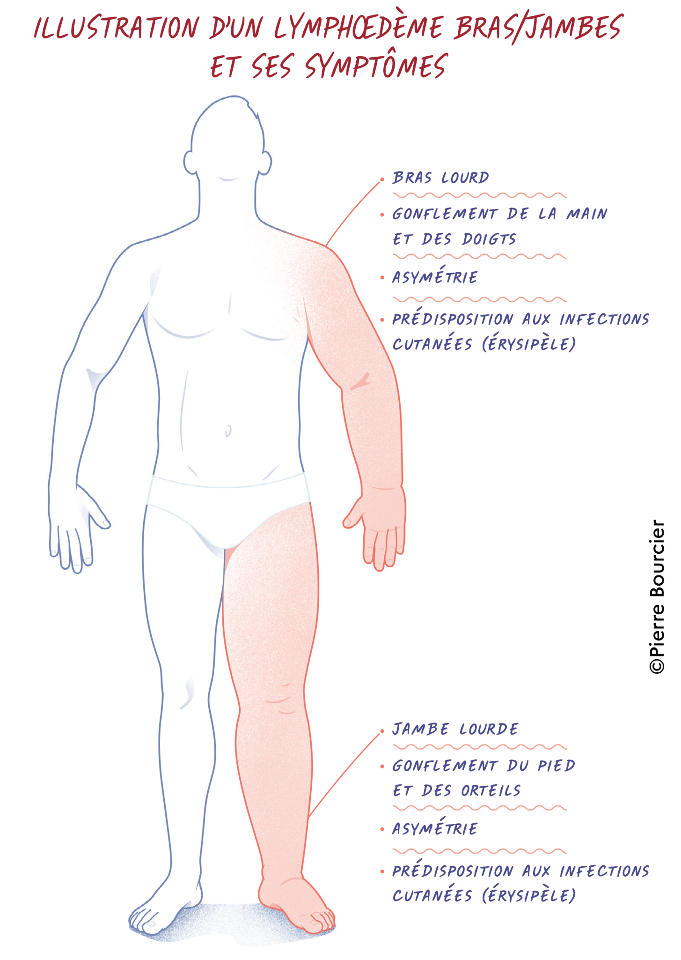 Tamoxifène Comment Acheter