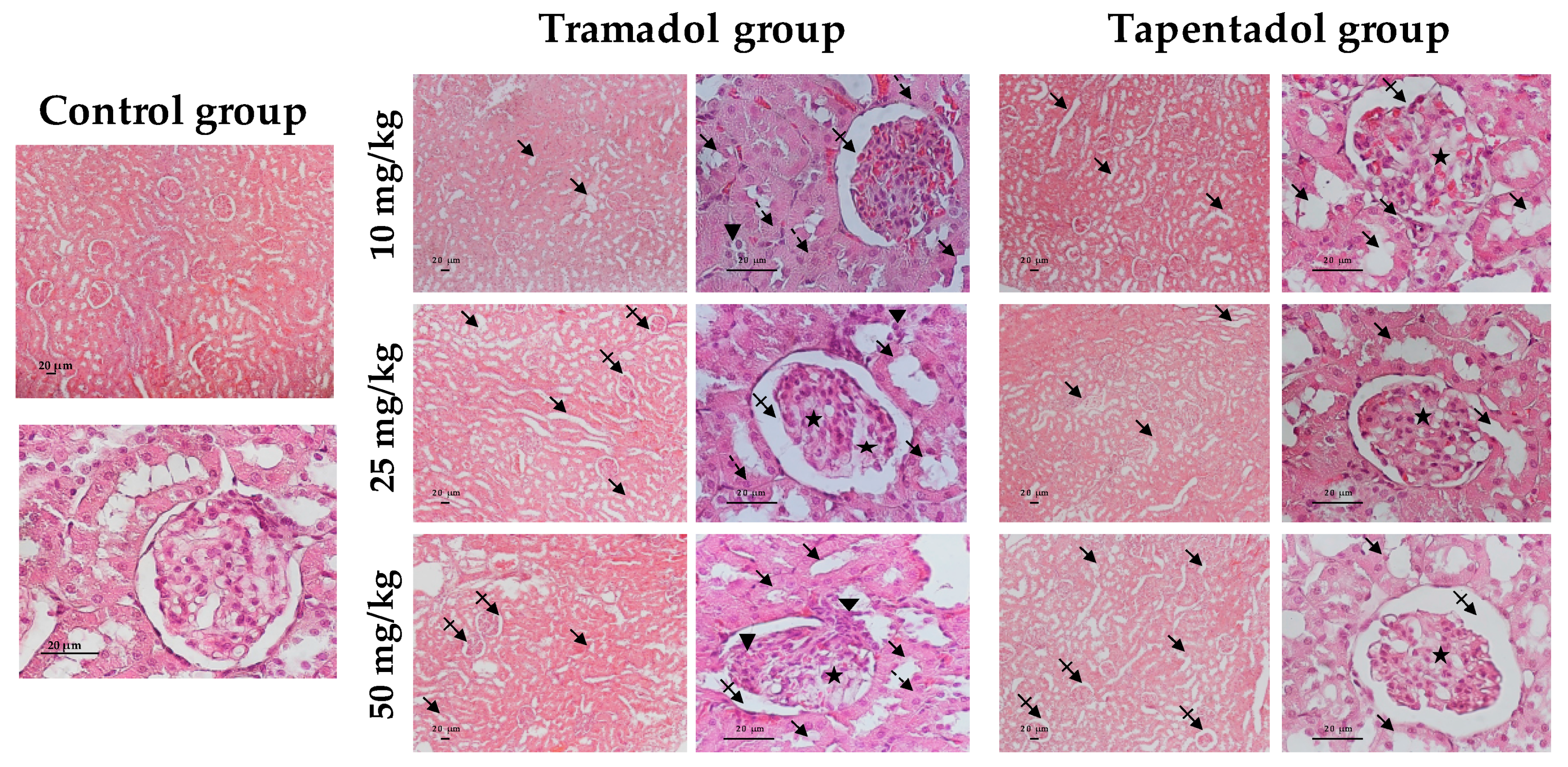 Tramadol france inter